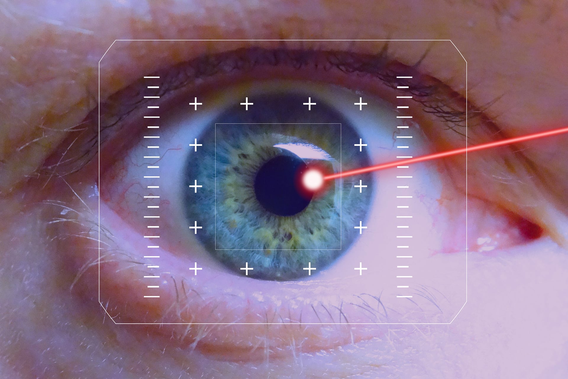 eye_surgery_colombia_dr_eugenio_cabrera_prelex_plus_lens_replacement_bogota-meta.jpg